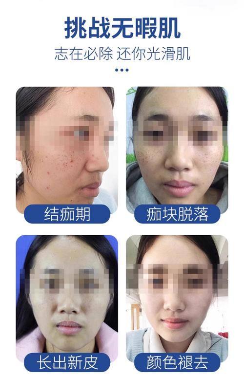 李惠芹医生技术优势