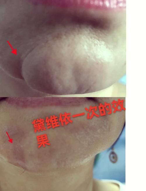 郑旻树医生怎么预约