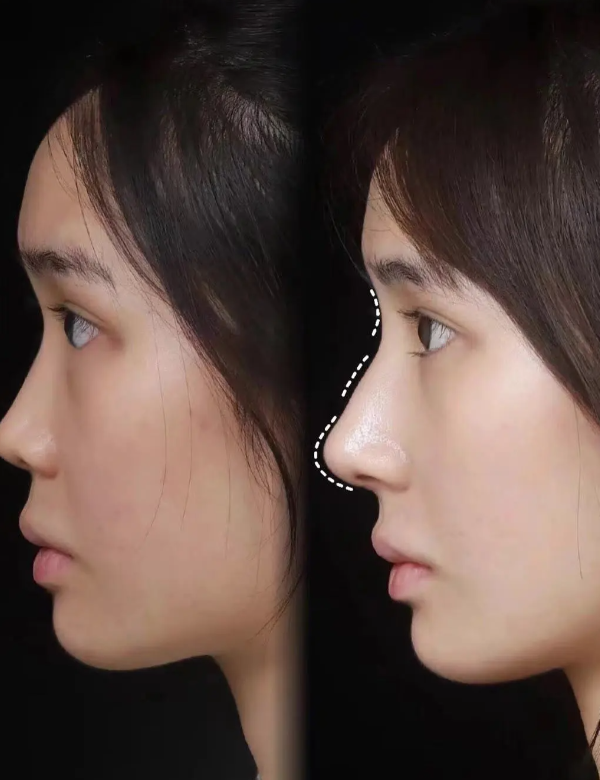 新疆王共礼整形伊宁分院地址电话及营业时间：