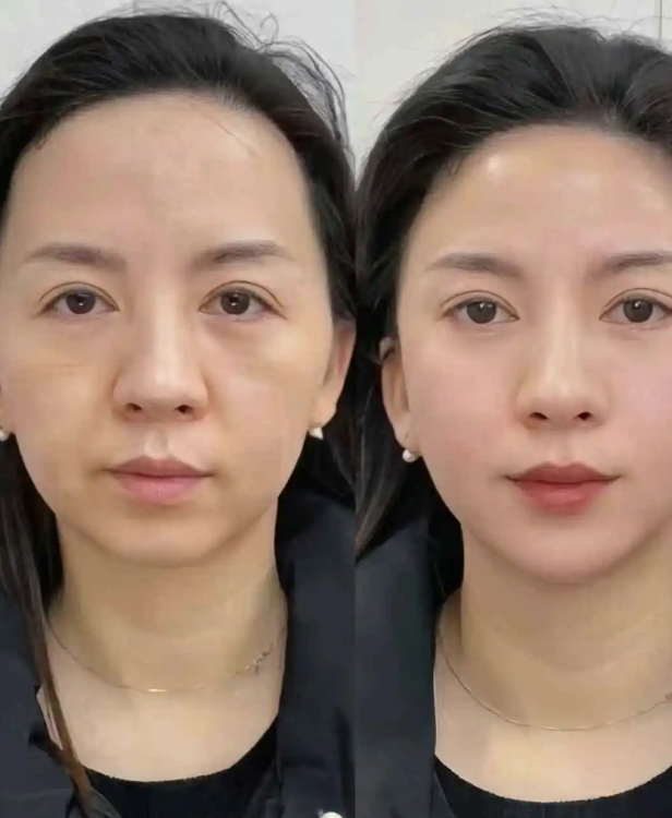 贵阳泰康乐医院整形外科口碑评价：