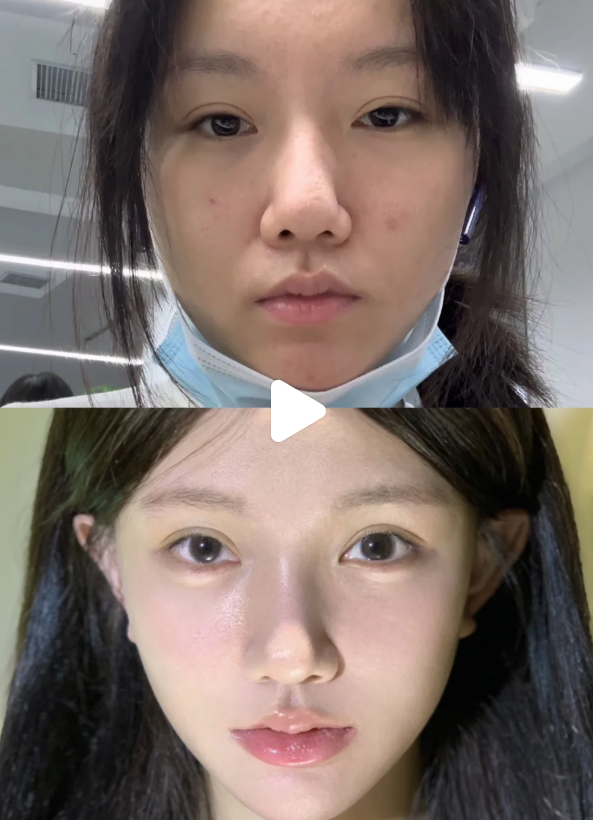 眉山美丽部落医疗美容诊所价格表：