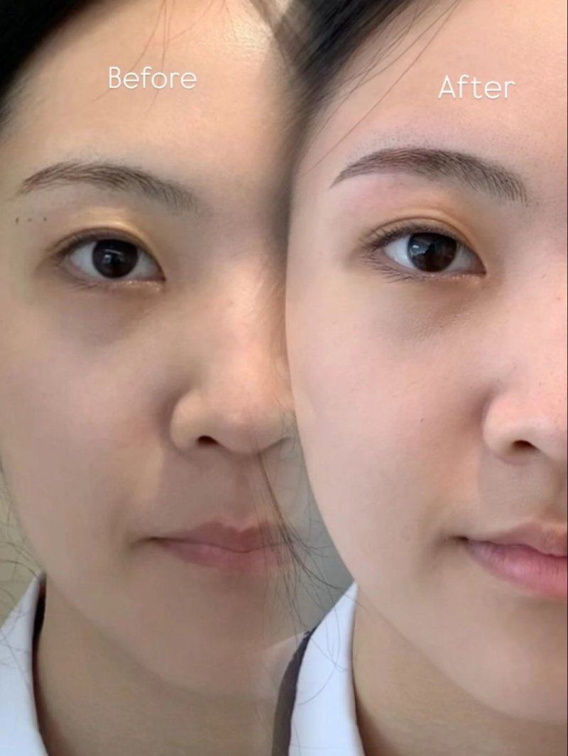 南京柠檬医疗美容诊所擅长项目: