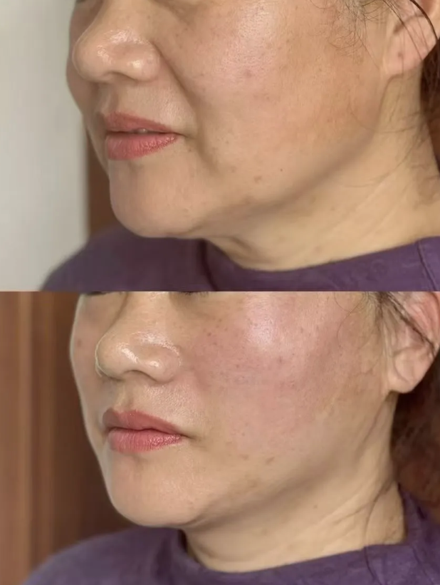 南京柠檬医疗美容诊所怎么样?