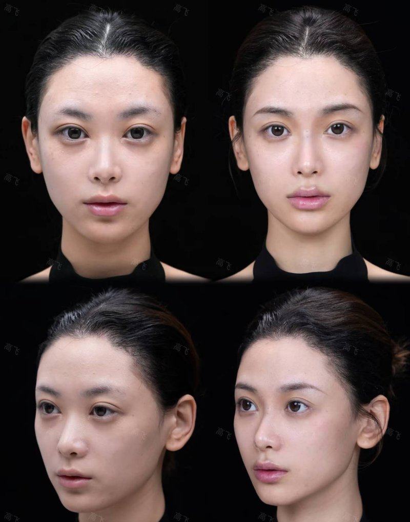 武汉一美整形美容门诊部地址电话及营业时间：