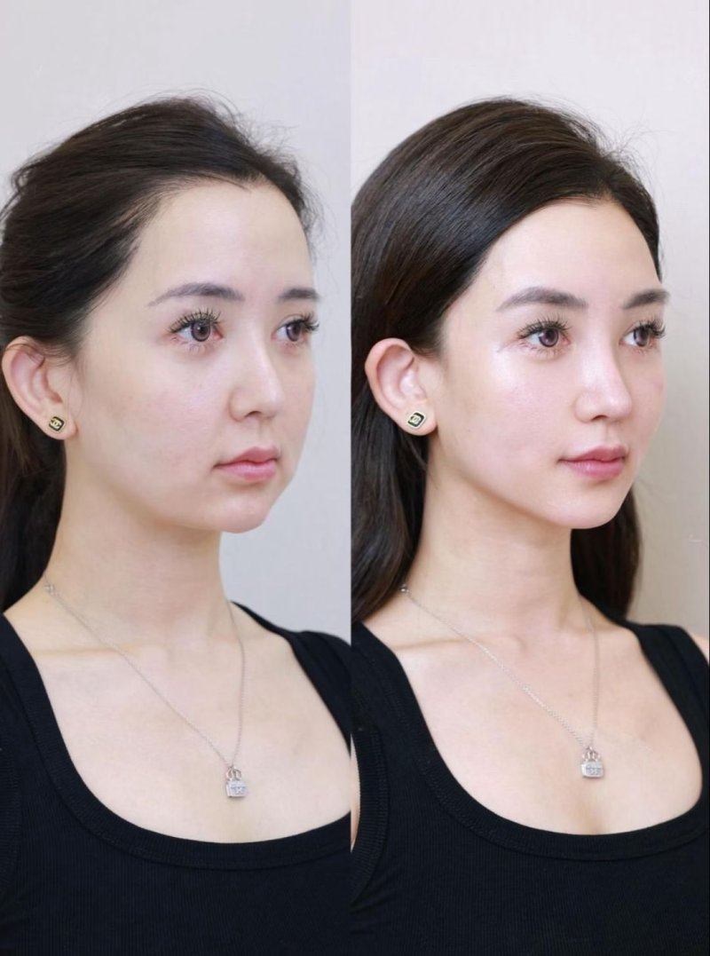 阮晓莹医生技术优势