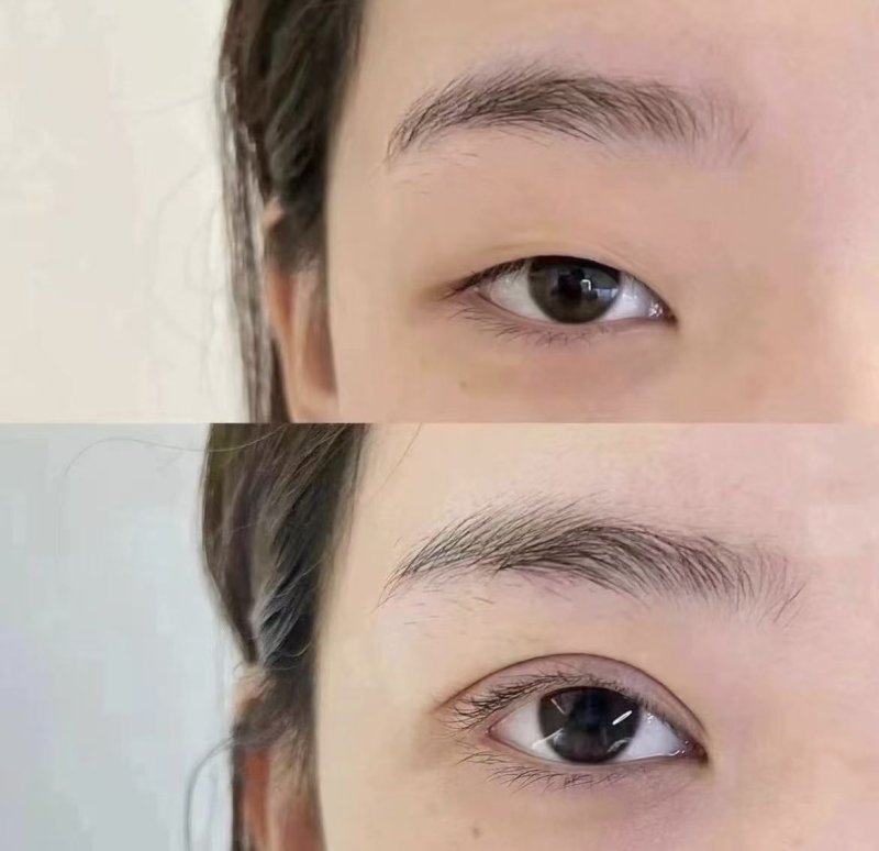 山东潍坊悦享美整形医院口碑评价: