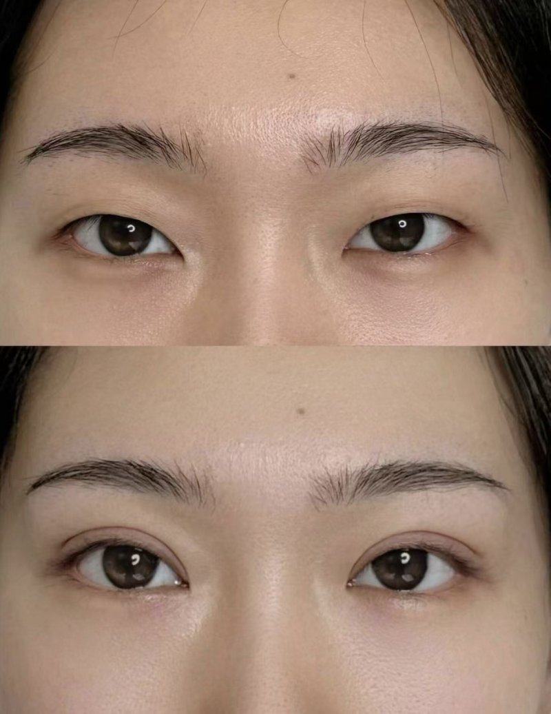 大连和颜一美恒乔整形医院口碑评价：