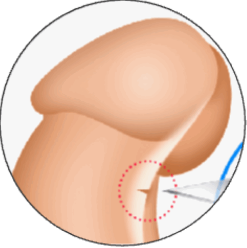 国内中铁阜阳中 心医院(手足显微整形外科)擅长项目：