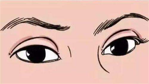 二、大腿抽脂术后多久能正常走路