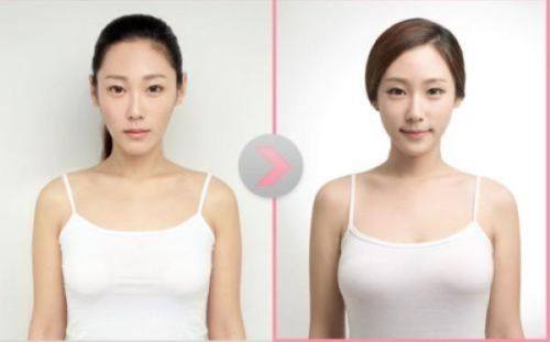 深圳雅唯整形医美门诊部价格表: