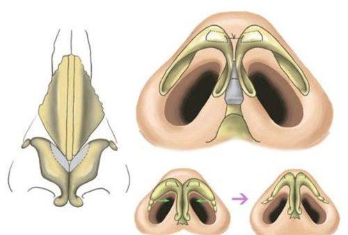 成都艺美汇整形医疗美容医院口碑评价: