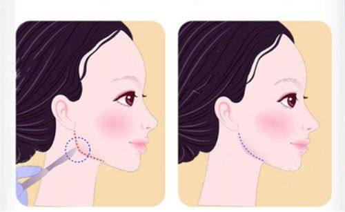 二、国有VS私立：内切眼袋该选哪种机构？