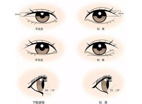 四、同位素放射治疗:能治好疤痕疙瘩吗?