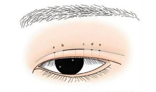 六、疤痕疙瘩治疗的避坑指南