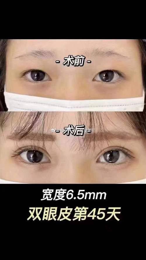 金华东阳丽莱医疗美容门诊部擅长项目：