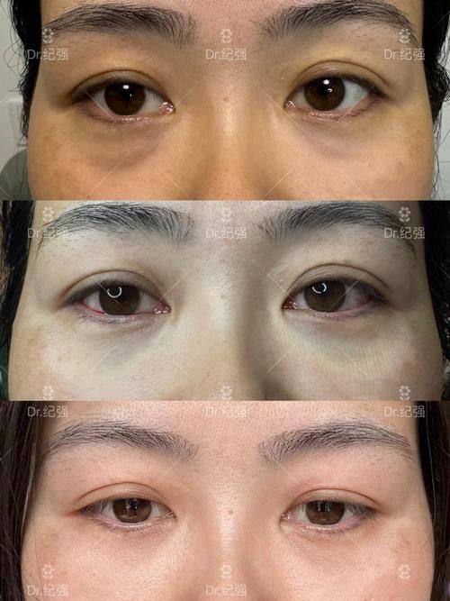 武汉上城医疗美容门诊部口碑评价: