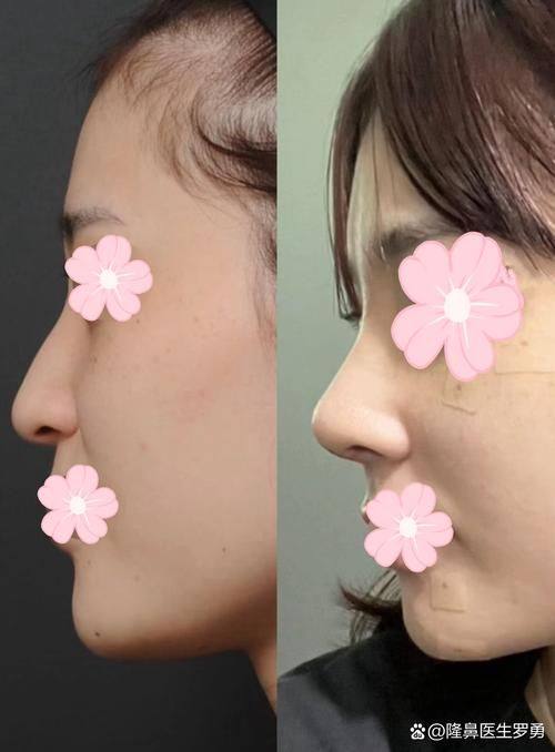 武汉上城医疗美容门诊部擅长项目: