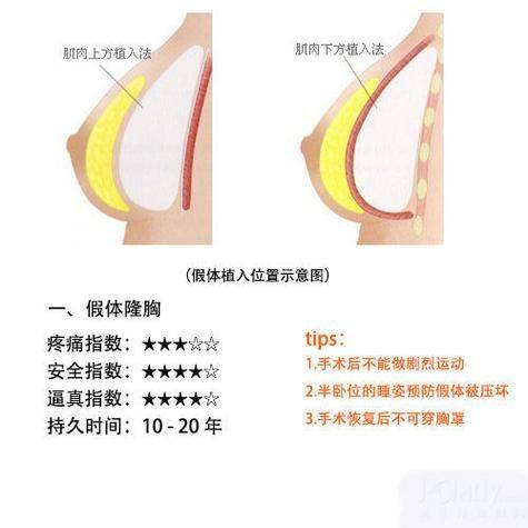 泰国杰作整形外科擅长项目