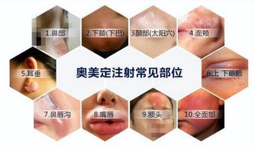 九江婕熹卡医疗美容门诊部擅长项目: