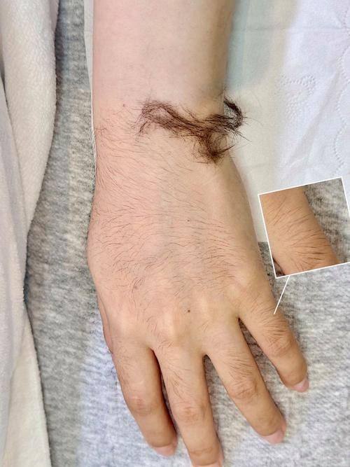 邓飞艳医生口碑评价