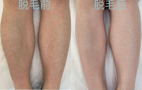 邓飞艳医生技术优势