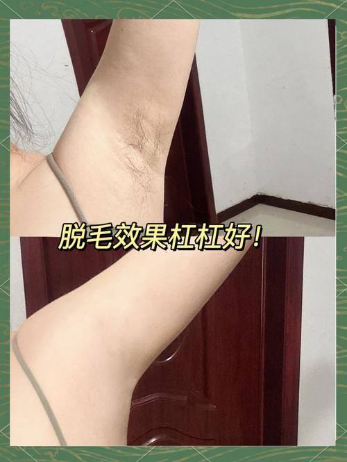 邓飞艳医生怎么预约