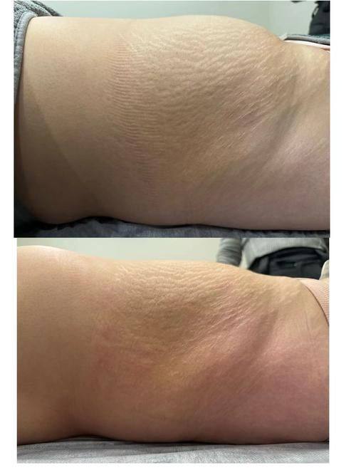 常熟美贝尔美容医院擅长项目: