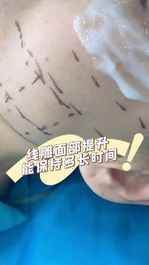 宋秀娥医生怎么预约