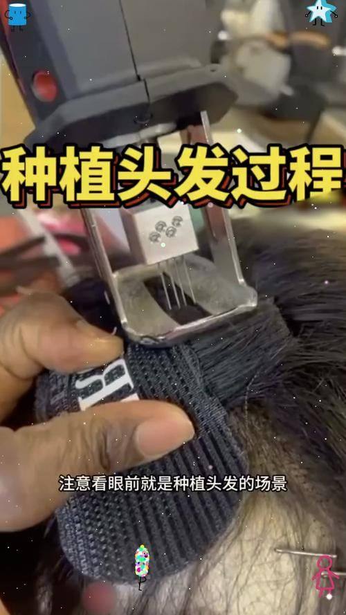 成都艺美汇整形医疗美容医院医生名单及擅长领域: