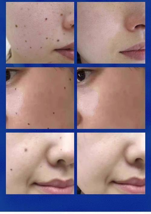 成都艺美汇整形医疗美容医院价格表: