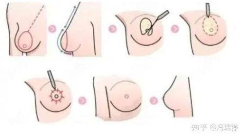 蔡振勇医生口碑评价