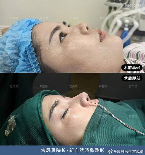 瑞恩整形外科擅长项目: