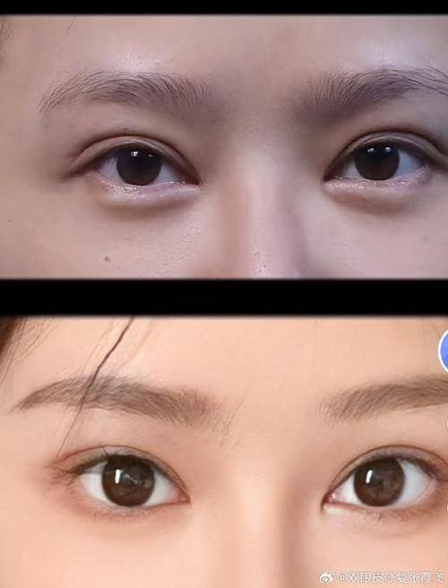 张宇恒医生怎么预约?