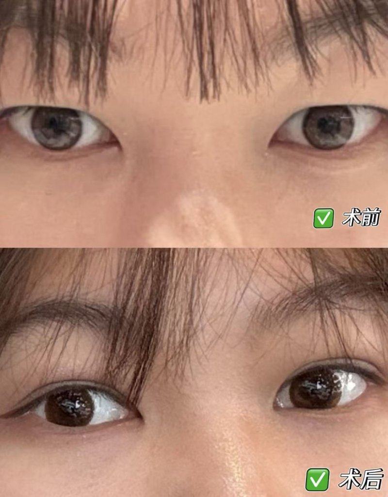 汨罗圣美医疗美容诊所预约挂号方式: