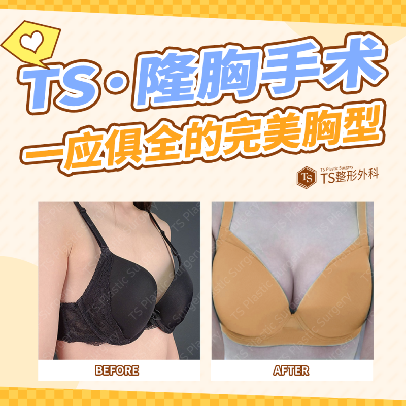 五、修复期除同房外，这些乳房保护要点也别忽略