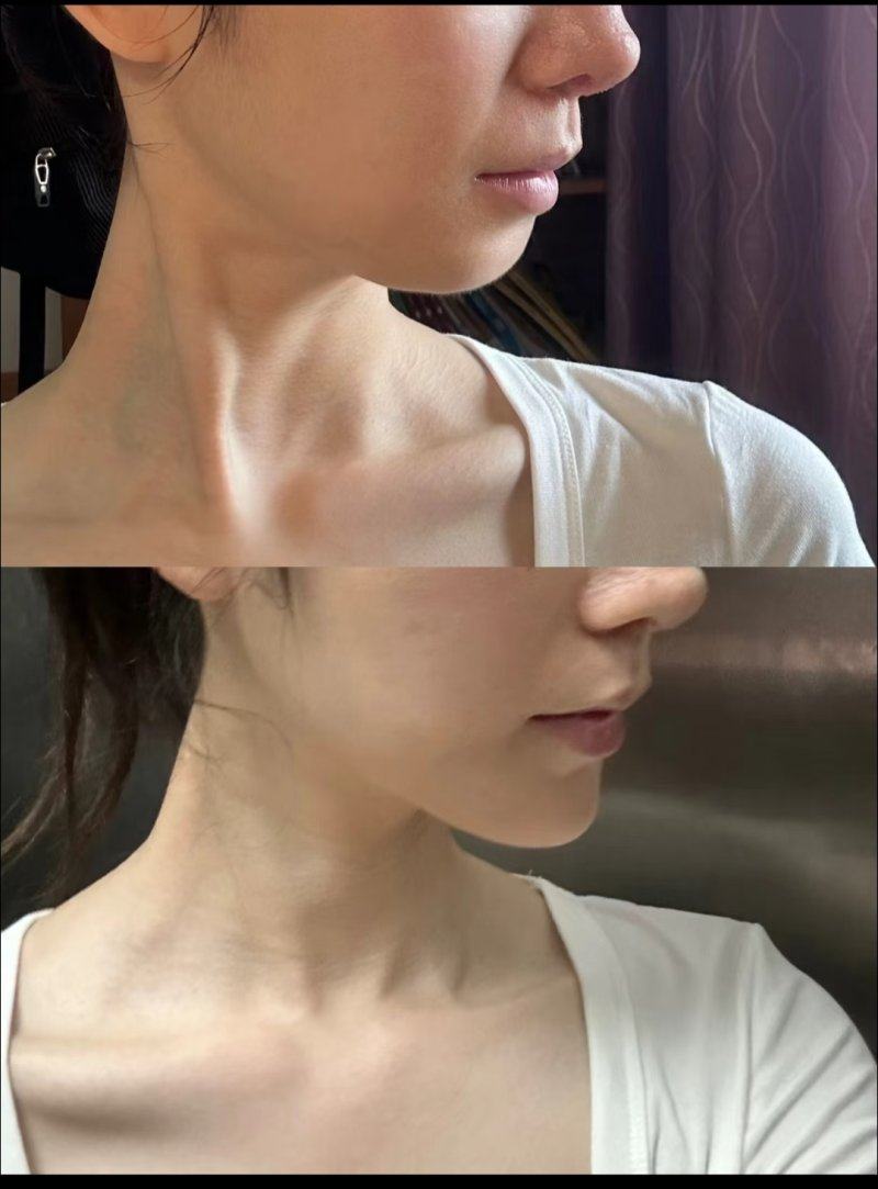 青岛知颜智妍医疗美容门诊部(青岛艾菲)怎么样