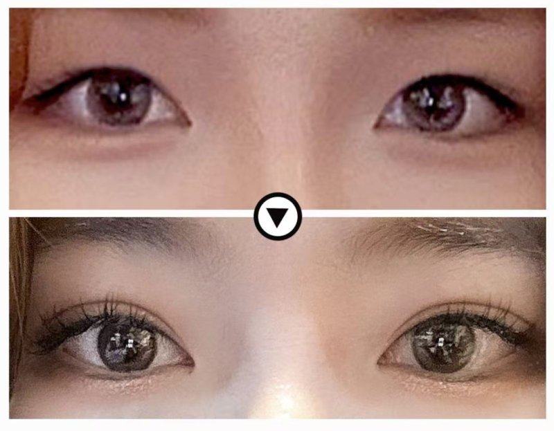 汨罗圣美医疗美容诊所怎么样?