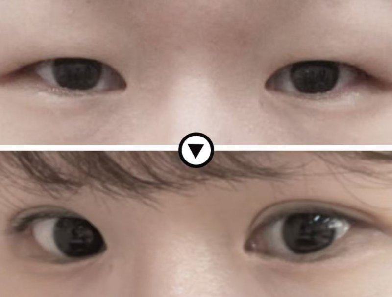 汨罗圣美医疗美容诊所价格表: