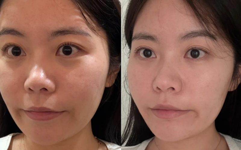 吴大毛医生技术优势