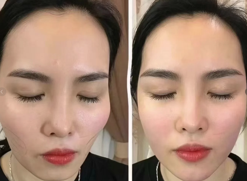 泰国杰作整形外科口碑评价