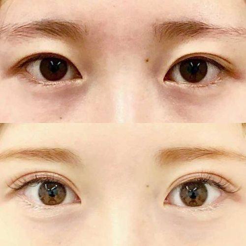 川北医学校附属医院烧伤整形美容科价格表