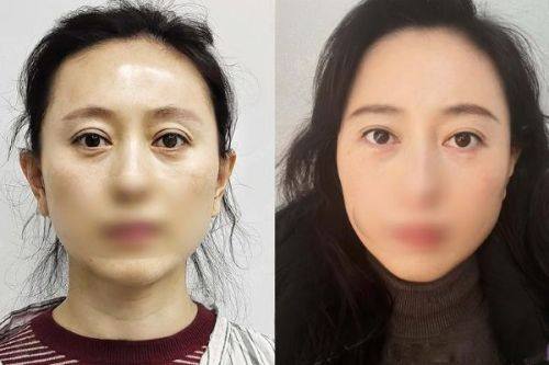 沈阳丽仙医疗整形美容诊所擅长项目：