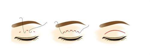 三、选对宽度:适配自身才是好看的关键