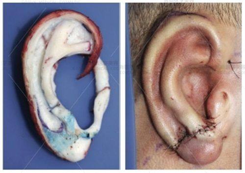 三、材质技术:专属记忆凝胶vs经典稳定工艺