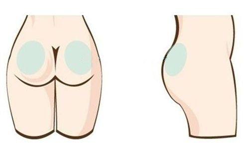 五、设计与适配人群:东方定制化vs全类型覆盖