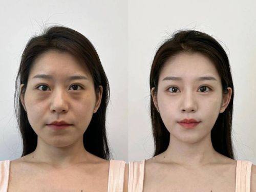 重庆市妇幼保健院(医学美容科)擅长项目：