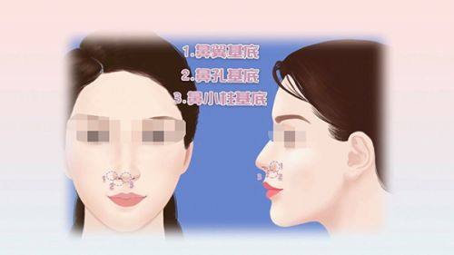 四、长期频繁注射的潜在危害