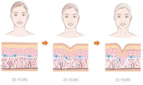 四、凹凸疤痕用什么药膏管用?凹凸疤痕用什么祛疤膏