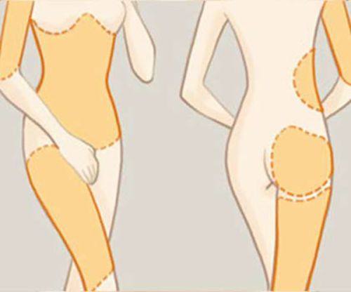 二、医生技术：缩短疤痕期的核心前提