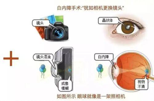 三、术后护理：加速疤痕淡化的关键加持